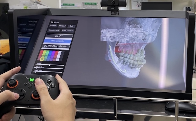 下顎骨3Dモデルをゲームコントローラーで操作している実画面
